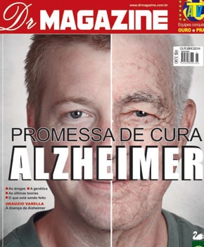 Promessa de Cura Alzheimer – Dr. Magazine